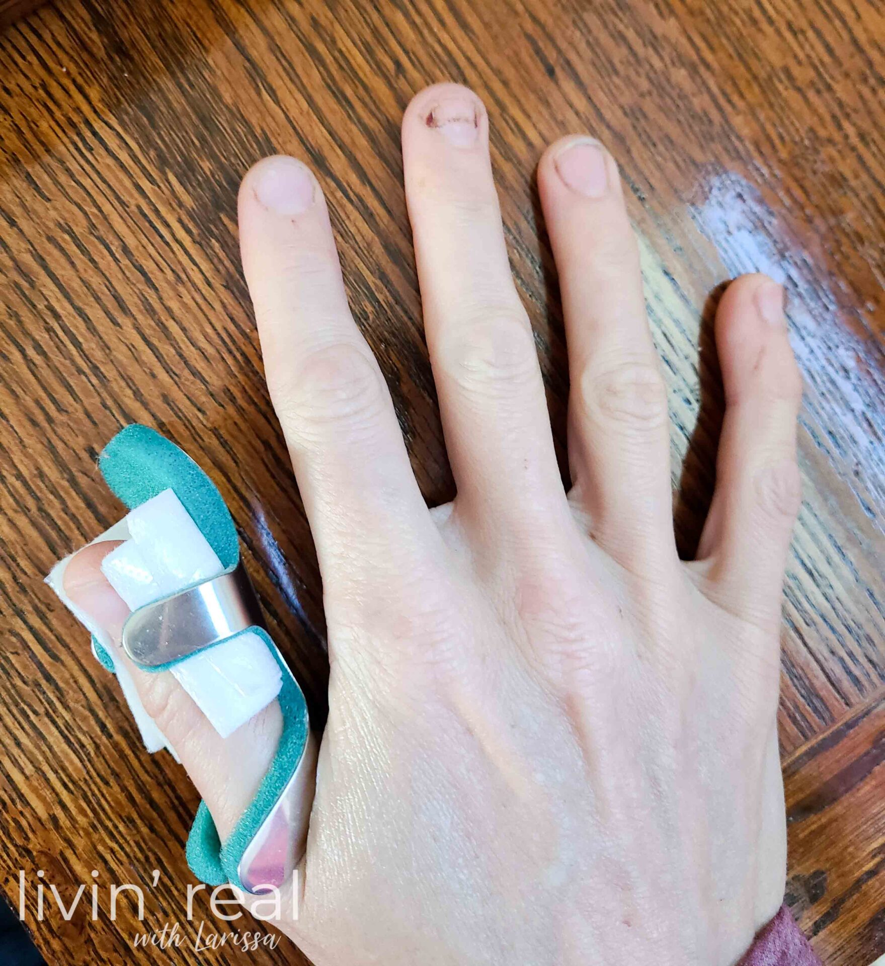 Larissa with Injured Hand | livinrealwithlarissa.com #livinrealwithlarissa Larissa with Injured Hand | livinrealwithlarissa.com #livinrealwithlarissa